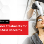 Top 5 Laser Treatments for Common Skin Concerns